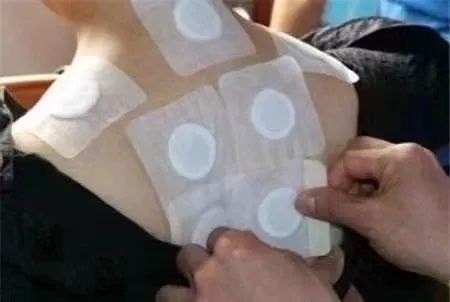 冬病夏治“三伏贴”——呼吸疾病怎样贴？看这一篇就够了！